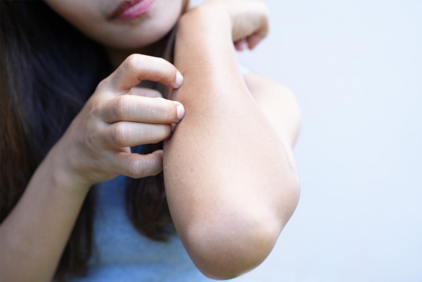 10 Effective tips to prevent weather-induced eczema flare-ups